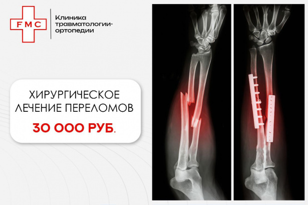 Хирургическое лечение переломов