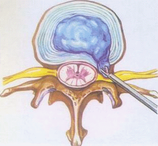 f00a3f5ac3733e363ef41c9b037dfe49.gif f00a3f5ac3733e363ef41c9b037dfe49.gif